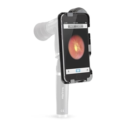 Welch Allyn IExaminor for the iPhone 6