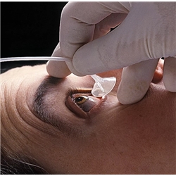 Morgan Medi Flow Lens - Each