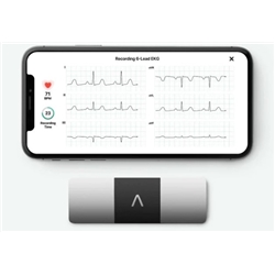 KardiaMobile ECG 6 Lead