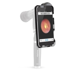Welch Allyn IExaminor for the iPhone 6 PLUS